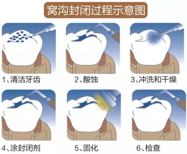 关爱牙齿，健康六一！鲁西骨科医院口腔科关爱儿童口腔健康活动开始啦！