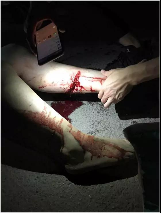 为正能量点赞！鲁西康复医院康复师下班途中救助车祸患者