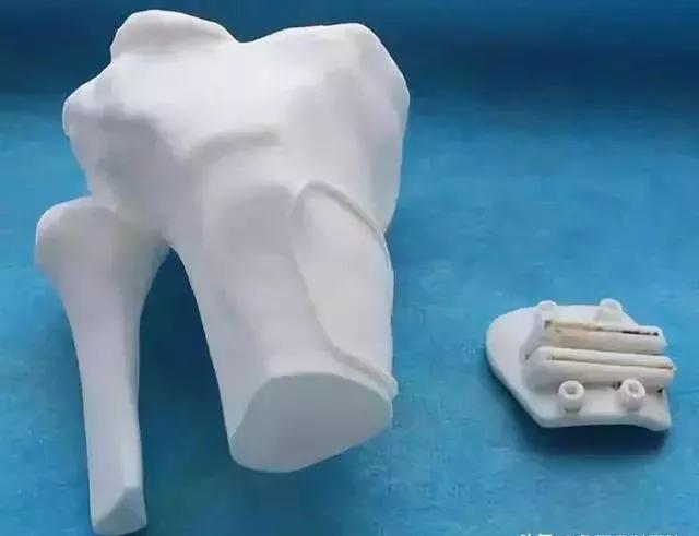 鲁西骨科医院骨科3D打印实验室揭牌